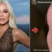 Khloe Kardashian pokazala lice nakon operacije melanoma, ostalo joj veliko udubljenje